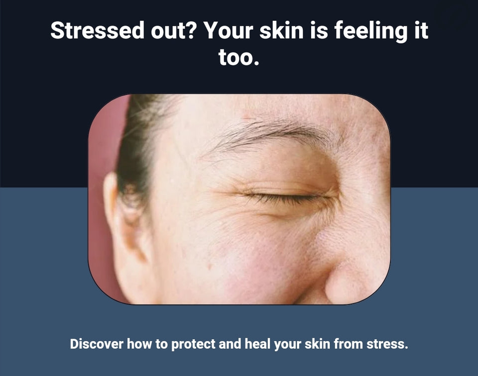 The Surprising Effects of Stress on Your Skin: Tips for a Healthier Complexion