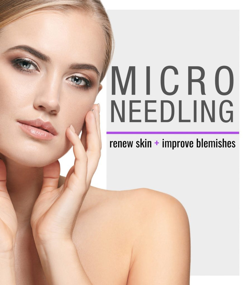 Comfort Microneedling: Everything You Need to Know To Do Microneedling At-Home